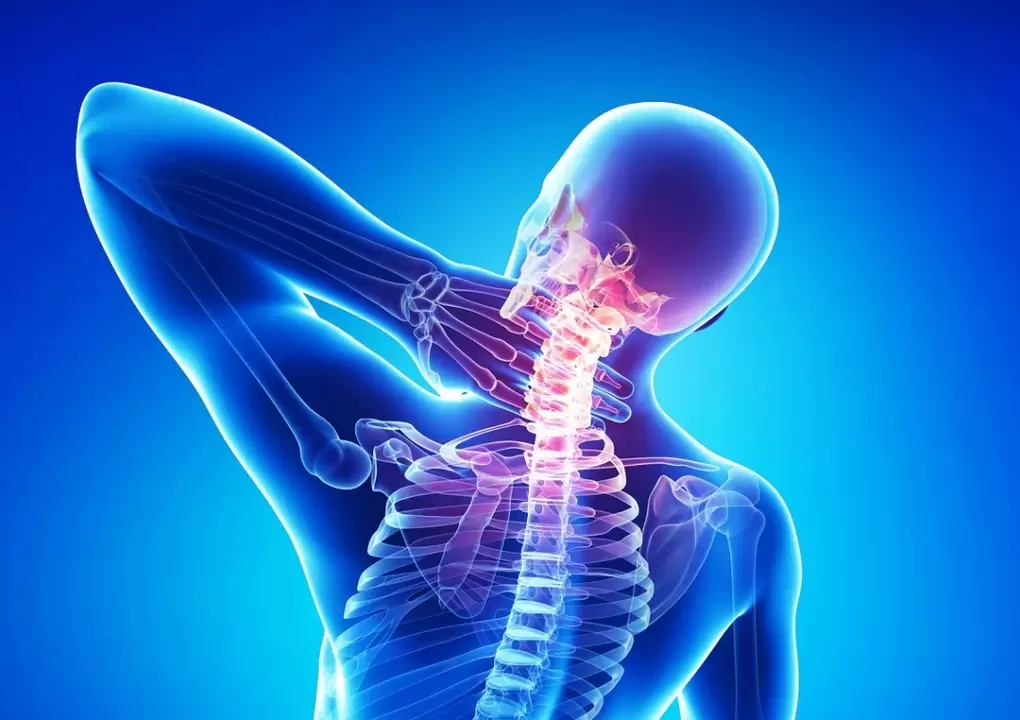 Is galar den spine é osteochondrosis